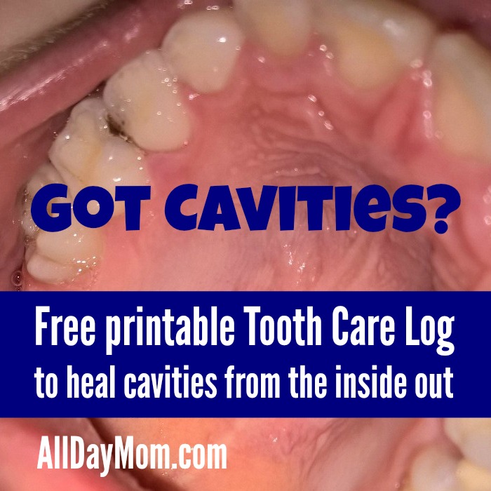 How to Heal Cavities Naturally and Free Printable Tooth Care Log for Kids - All Day Mom